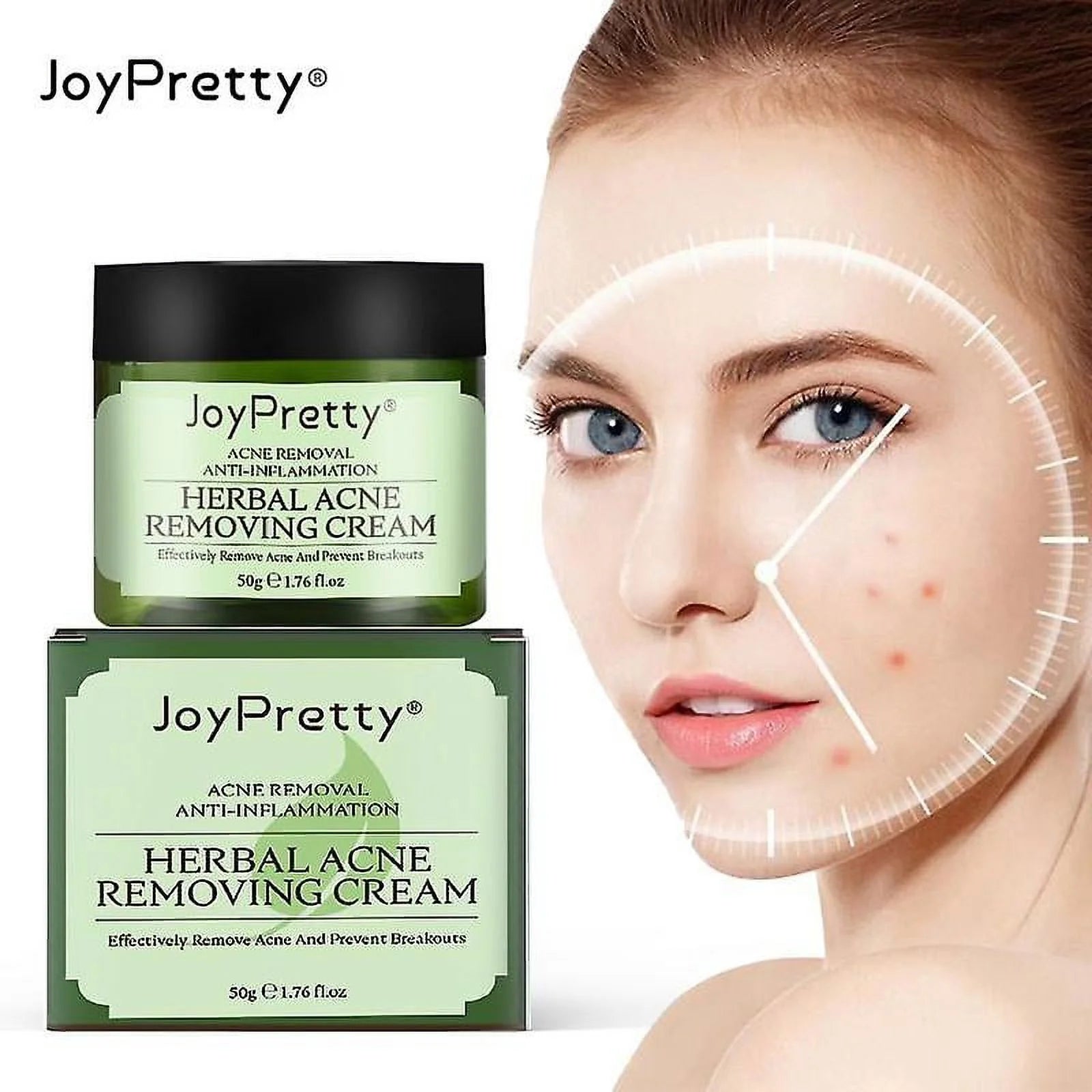 Herbal Acne Cream - Joypretty Herbal Day Cream For Acne Skin Care Face Moisturizer
