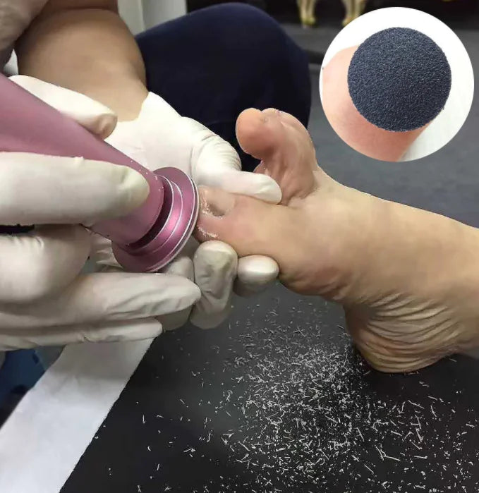 Electric Pedicure Tool